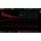 FFT as spectrum analyser